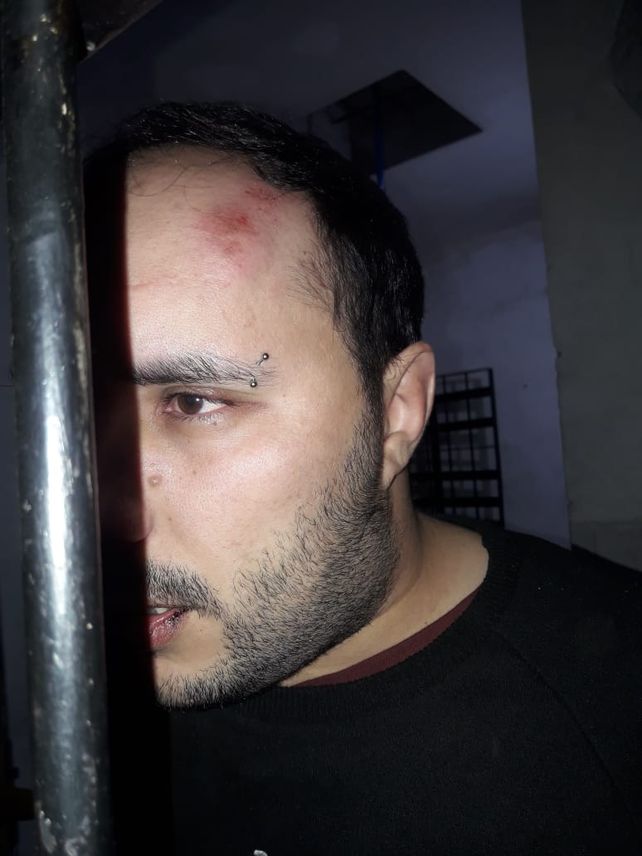 Cañada de Gómez: fue a denunciar una fiesta clandestina y terminó preso y malherido