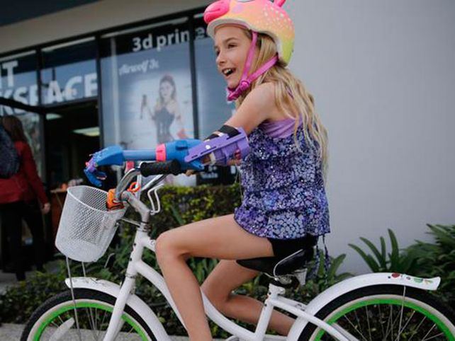 Impresión en 3D permite a niña tener prótesis de mano