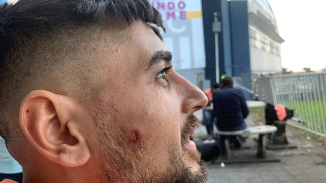 El fotógrafo de Radio Boing, Farid Dumat Kelzi, recibió un impacto de bala de goma en el rostro, en la previa del partido de Central.
