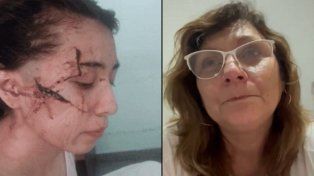 Delfina, la chica de 15 tajeada en la cara, y Sandra, la abuela de otra adolescente atacada.