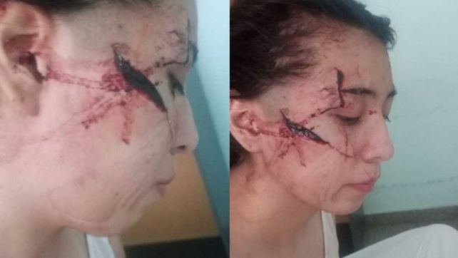 Brutal agresión a una adolescente en San Cristóbal: investigan un ataque planificado y hay tres detenidos