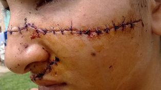 Formosa: dos chicas le desfiguran la cara a otra a cuchillazos por ser linda