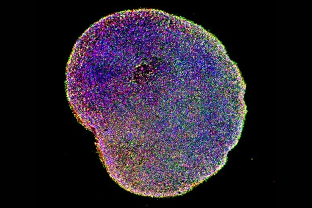 Un organoide cerebral