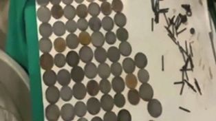 Un granjero indio combatía su depresión comiendo monedas, clavos  y tornillos