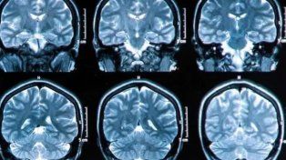 El estudio de investigadores, hicieron escáneres de cerebros y determinaron las fases del mismo en la vida y hasta cuándo es la adolescencia&nbsp; 