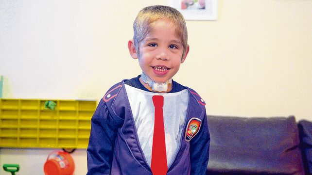 Wally, el nene que le hace frente a un extraño mal