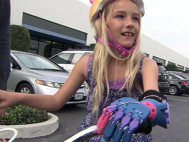 Impresión en 3D permite a niña tener prótesis de mano
