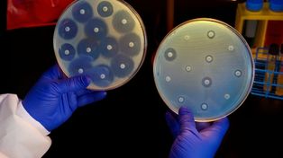 La OMS urge a hallar nuevos antibióticos para una docena de superbacterias