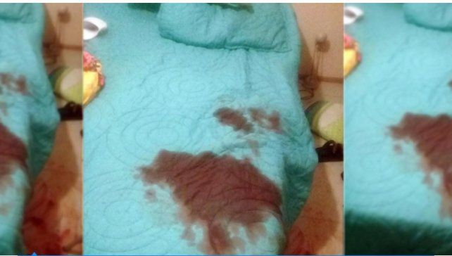 Juego sexual, ojos vendados y ataque: habló el hombre al que su amante le cortó el pene