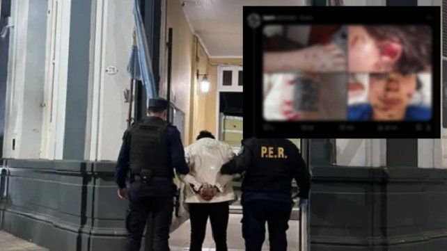 Intento de femicidio en Colón: violento golpeó y apuñaló con un destornillador a una joven