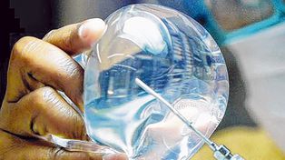 Denuncian un fraude mundial en el control de los implantes médicos