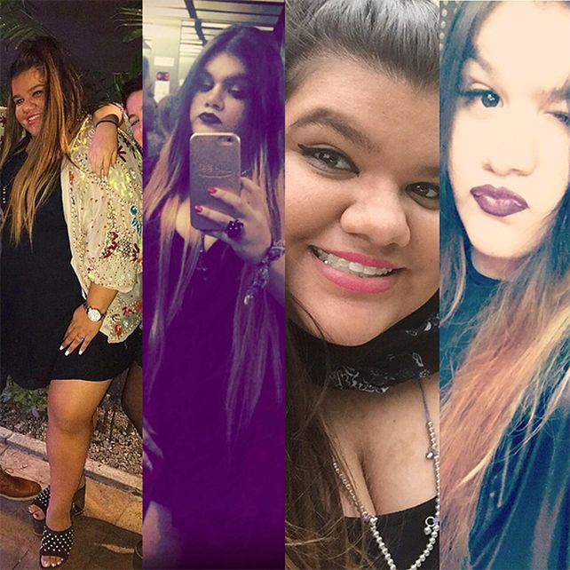 El antes y después de More Rial a un año del bypass gástrico