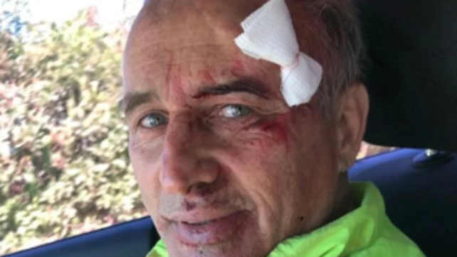 Héctor Baldassi tuvo un accidente con su bicicleta y envió un mensaje para concientizar