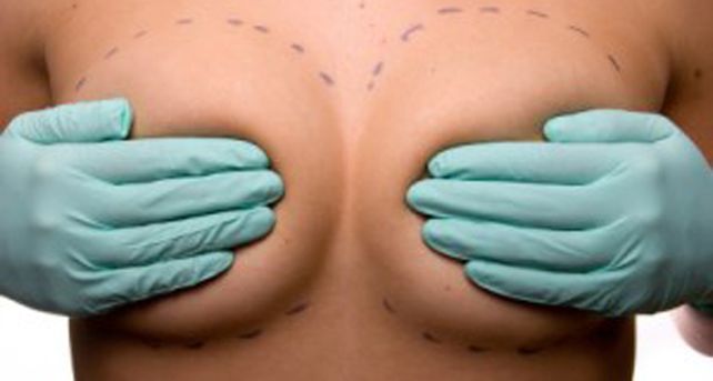 &iquest;Cada cu&aacute;nto hay que cambiarse los implantes de silicona?