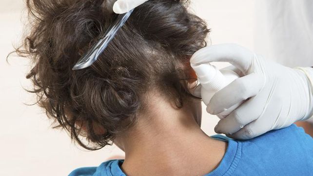 Traer dos piojos vivos, la desagradable e insólita tarea que una maestra les dio a sus alumnos