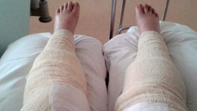Casi le amputan las piernas por hacerse un cavado