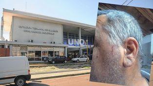 Así quedó el rostro de Carlos, el taxista agredido con un botellazo en la Terminal de Ómnibus.&nbsp;