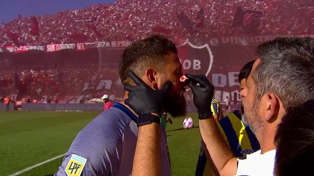 Broun recibió el impacto de un proyectil y sufrió un corte en la cara