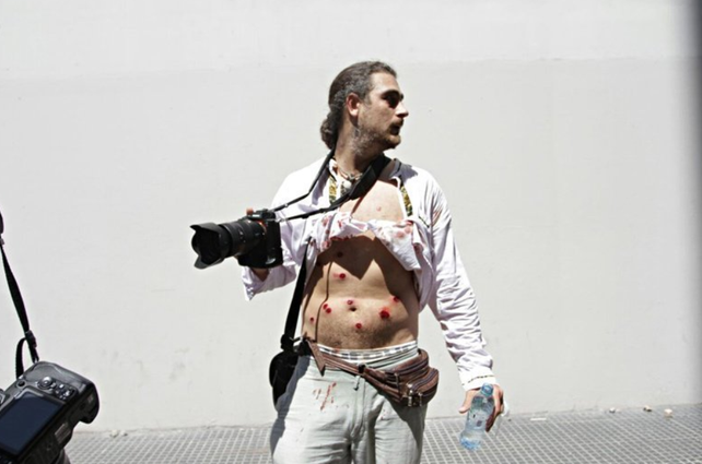 Quién es el fotógrafo que recibió diez impactos de balas de goma