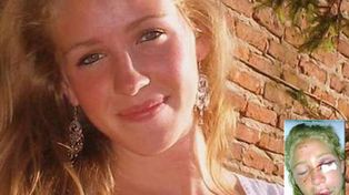 Un ex novio le desfiguró la cara por celos en una fiesta en Mar del Plata