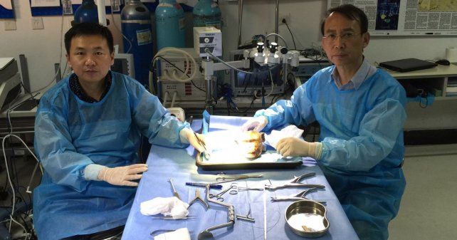 Fue un éxito el primer trasplante de cabeza en China