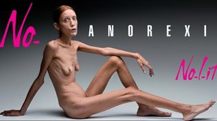 Falleci&oacute; la modelo francesa que desnud&oacute; su anorexia