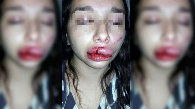 Intentaron violarla entre tres, se resistió y le desfiguraron la cara con un hierro