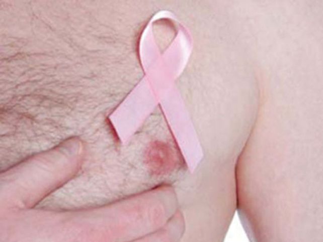 El cáncer de mama también puede afectar a los hombres