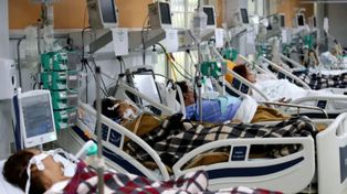 Brasil tiene más pacientes jóvenes que mayores en cuidados intensivos por coronavirus