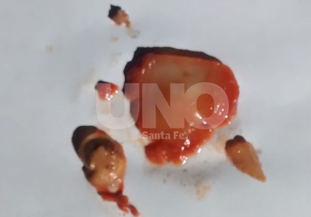 Análisis de muestra de puré de tomates: se debió a un desarrollo macroscópico de mohos