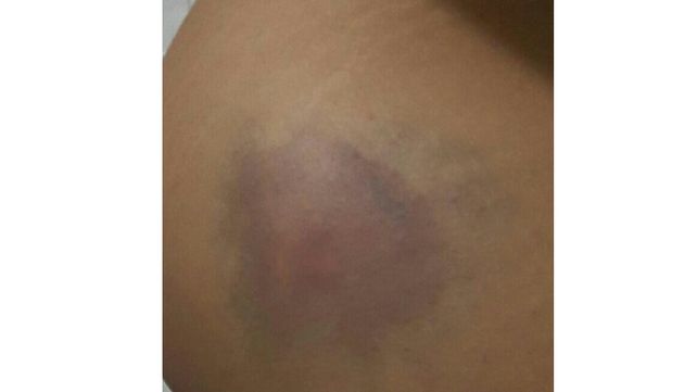 La chocó y se fue porque sus hijos llegaban tarde a la escuela
