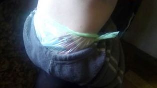 La foto de un nene con una bolsa como pañal que conmovió a todos