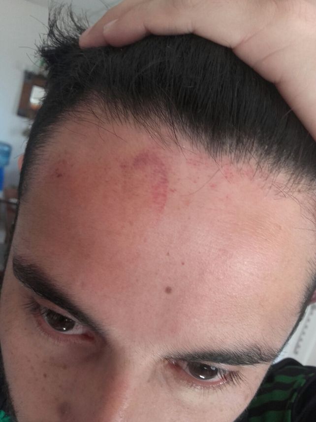 Árbitro golpeó a un técnico de Futsal hasta hacerlo convulsionar