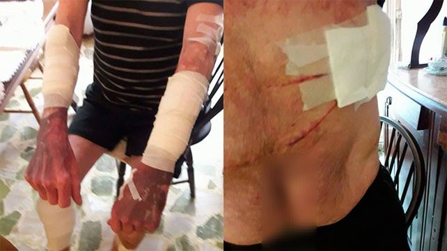 Apuñalaron, golpearon y ahorcaron a un hombre de 64 años para robarle