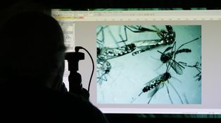 Confirman en Estados Unidos el primer caso de microcefalia por contagio del virus zika