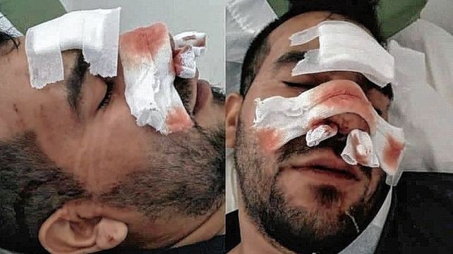 El joven se halla internado en Arroyo Seco tras la brutal paliza