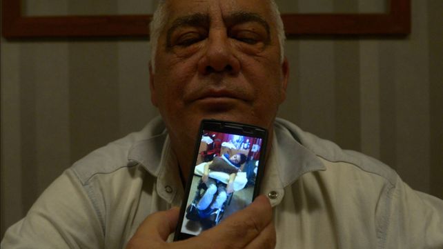 Una joven está postrada hace siete meses tras someterse a un implante mamario
