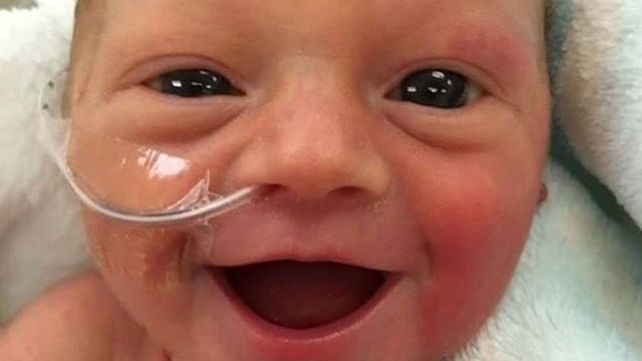 La imagen de esta bebé prematura que es pura sonrisa dio vuelta al mundo