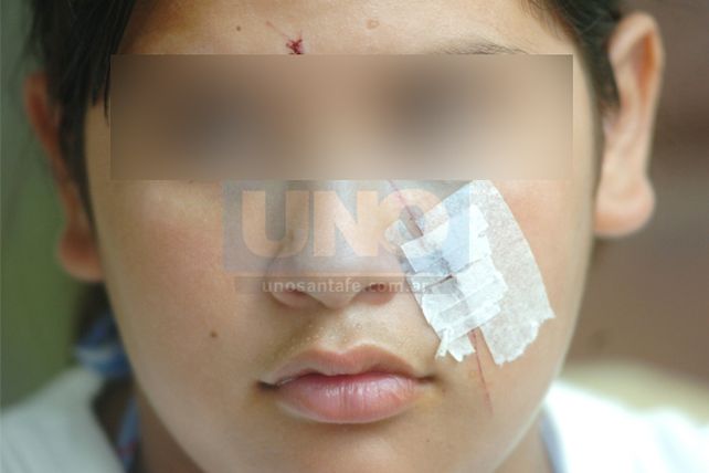 Una alumna de 12 años fue tajeada en el rostro por una compañera de curso
