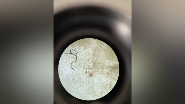 Vista microscópica de carne bovina con evidencia de micropláticos tipo fibra
