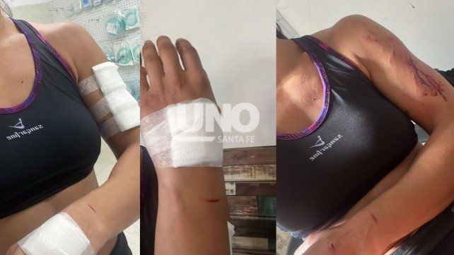 Otro brutal ataque de un perro pitbull. Esta vez ocurrió en la zona de San José del Rincón y la víctima sufrió fuertes mordeduras. Otro brutal ataque de un perro pitbull. Esta vez ocurrió en la zona de San José del Rincón y la víctima sufrió fuertes mordeduras.