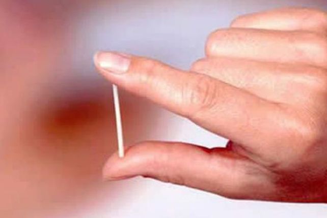 Santa Fe finalmente no recibirá el novedoso anticonceptivo que va en la piel