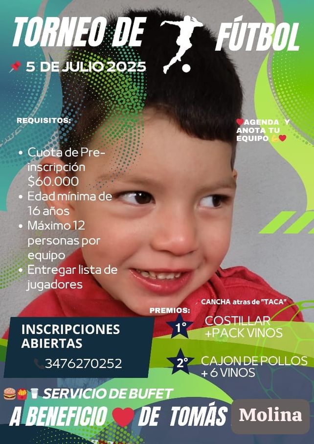 Tomi tiene 3 años y una terapia en México puede mejorar su calidad de vida afectada por una parálisis cerebral