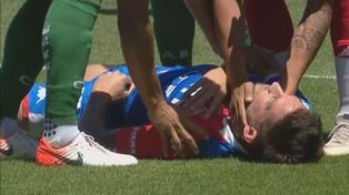 Mazzola sufrió la fractura del maxilar y podría ser operado