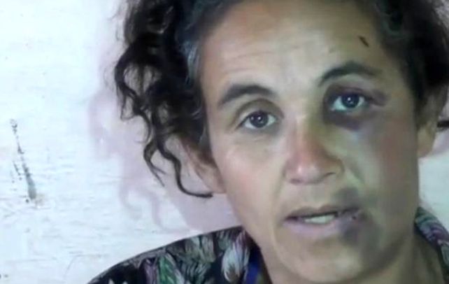 Casilda: la Justicia investiga la denuncia de una mujer golpeada por la policía
