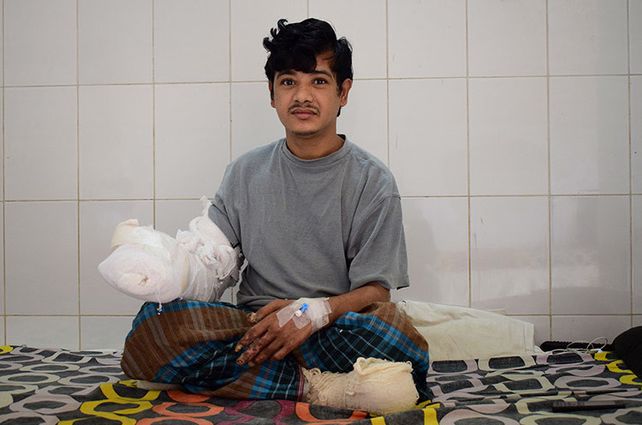 El hombre árbol de Bangladés por fin pudo abrazar a su hija