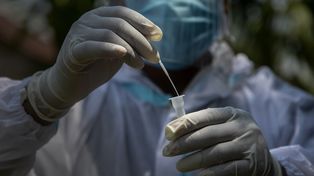Coronavirus: 24.801 nuevos casos y 375 muertes en las últimas 24 horas en el país