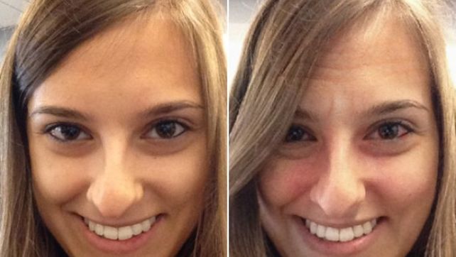 Lo que el alcohol le hace a nuestros rostros