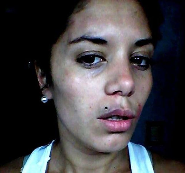 En medio del conflicto con el Polaco, aparecieron fotos de Valeria Aquino golpeada