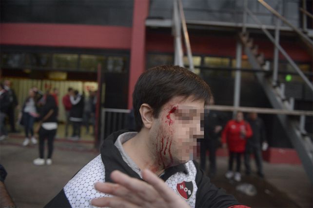 Herido. Uno de los asambleístas de Newells exhibe el golpe que sufrió dentro del club.&nbsp;